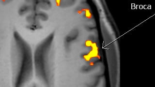 fmri1