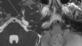 mriauditoarycanals2