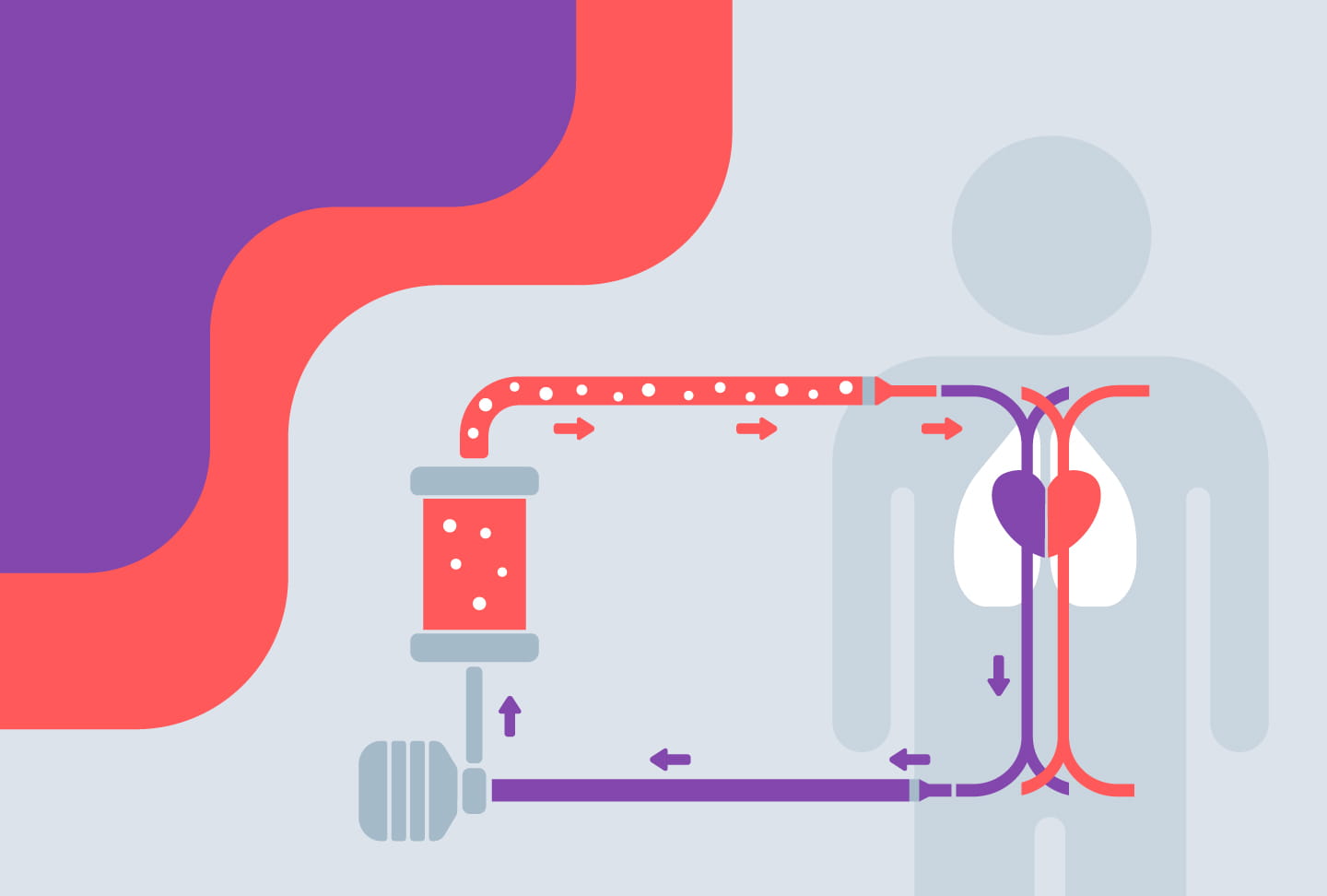 Illustration depicting ECMO treatment process